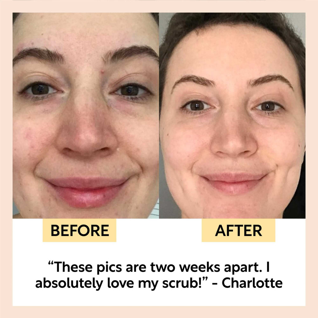 Travel-Size Skincare Bundle